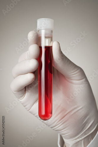 Doctor's hand with blood sample