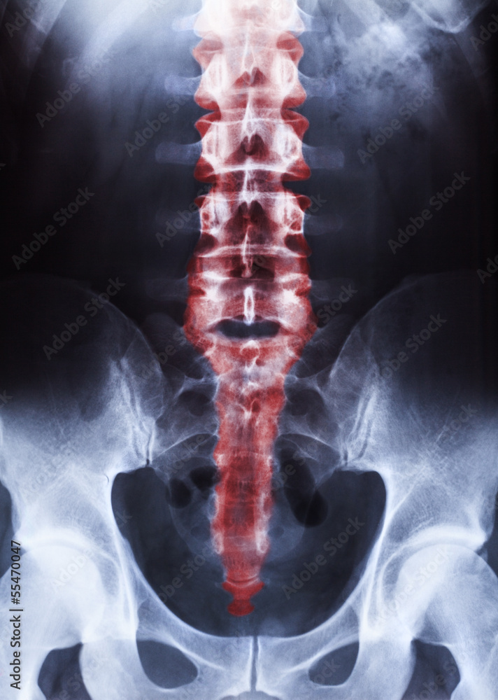 Lexaray Body human body on xray Stock Photo | Adobe Stock