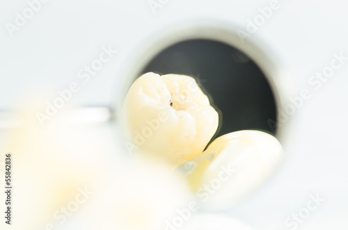 Extracted teeth and mouth mirror