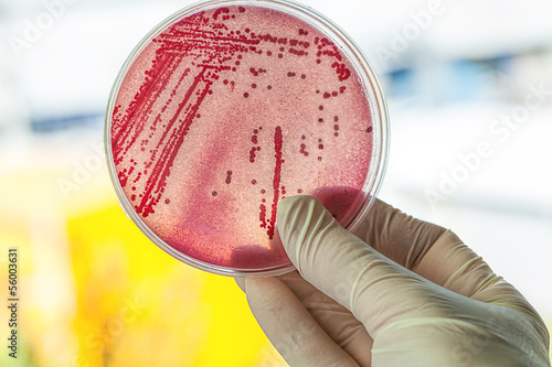 Canvastavla Petri dish with bacteria