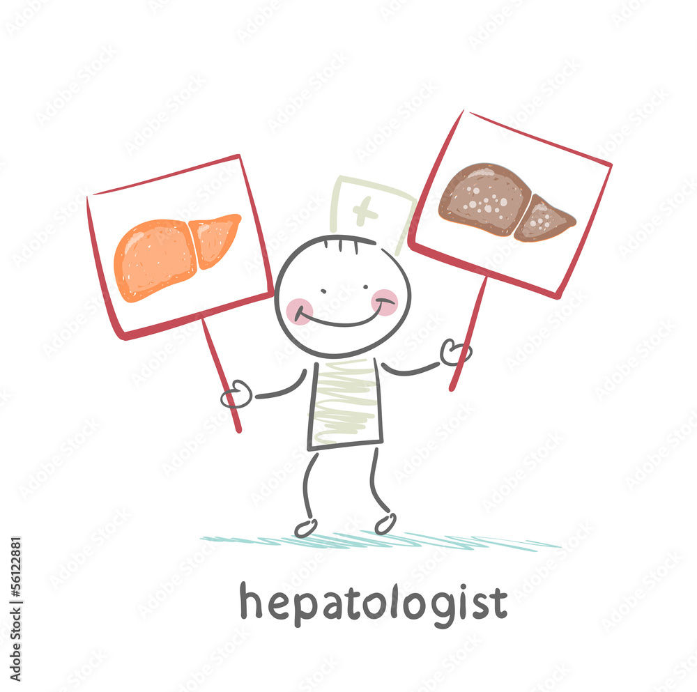 hepatologist holding signs with healthy and diseased liver hepatologist holding signs with healthy and diseased liver