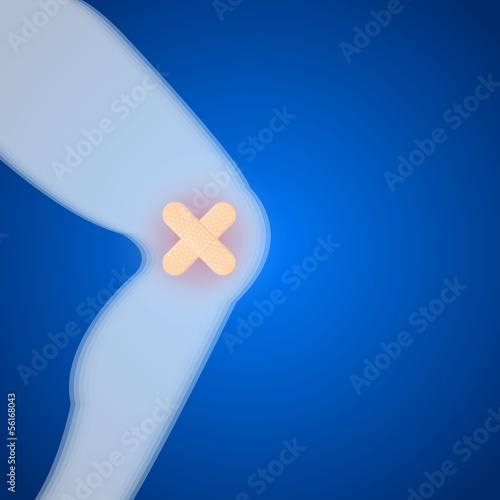 Knee injuries