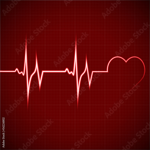 heart rhythm ekg
