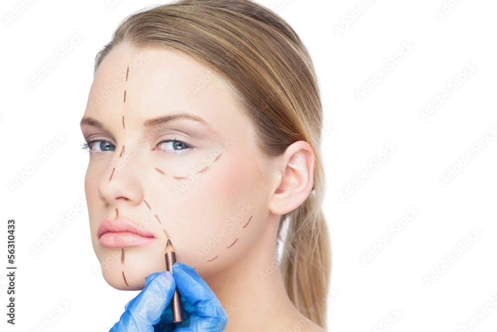 Surgeon drawing dotted lines on unsmiling patient Surgeon drawing dotted lines on unsmiling patient