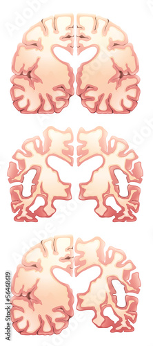 Human Brain
