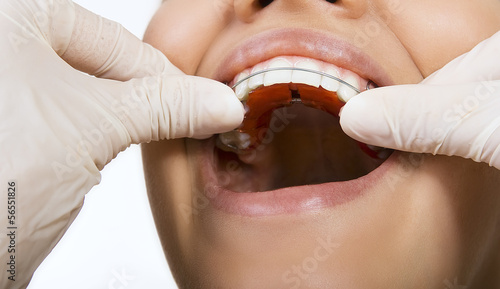 orthodontic doctor examine teeth and gums of jaw