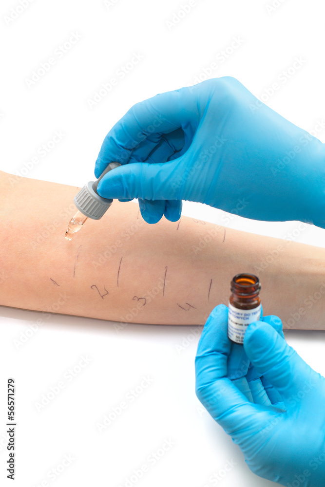 Naklejka premium doing a skin prick allergy test