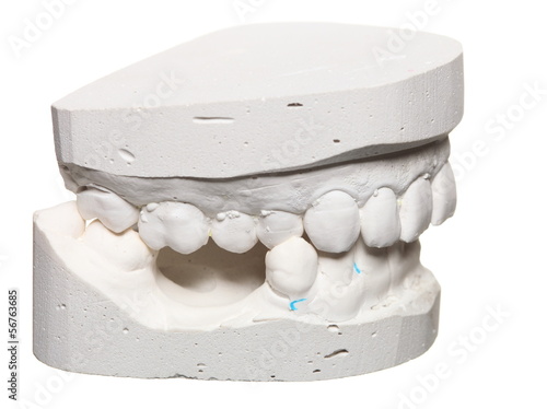 Dental gypsum model mould of teeth in plaster photo