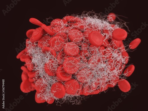 Blood clot photo