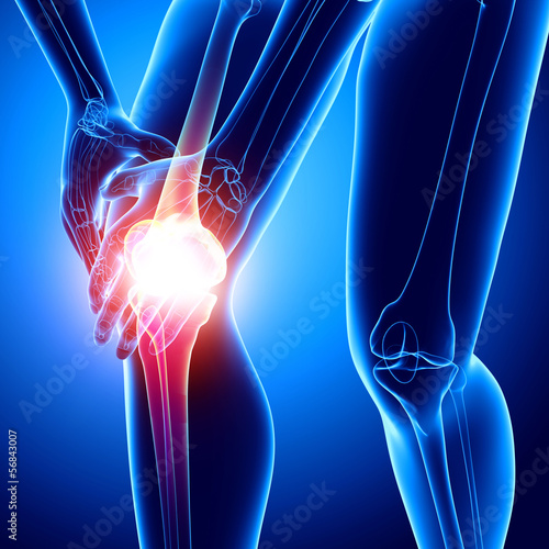 X-ray human of knee pain