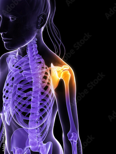 Foto 3d rendered illustration of a painful shoulder