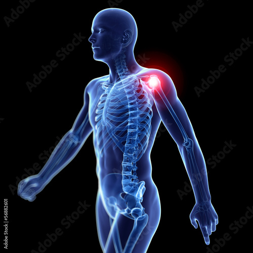 3d rendered illustration of a painful shoulder #56882601
