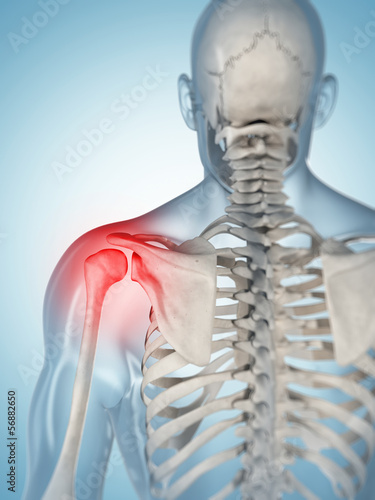 3d rendered illustration of a painful shoulder #56882650