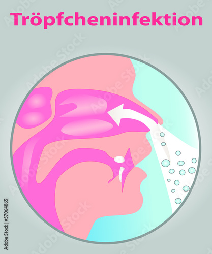 Tröpfcheninfektion_T2