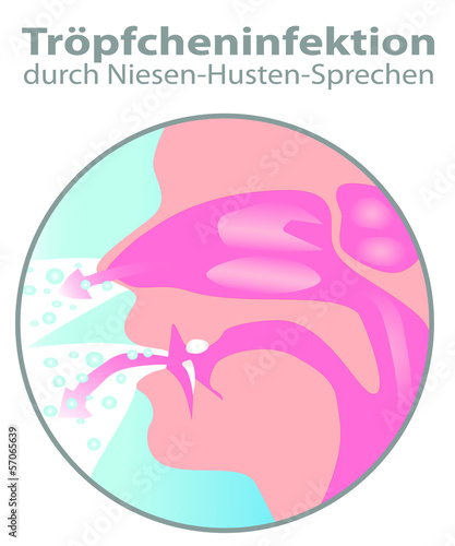 Tröpfcheninfektion durch Niesen & Husten