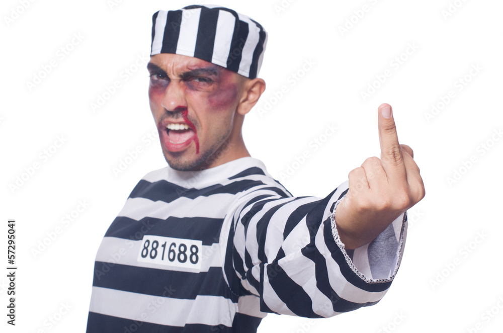 Prisoner with bad bruises on white Prisoner with bad bruises on white