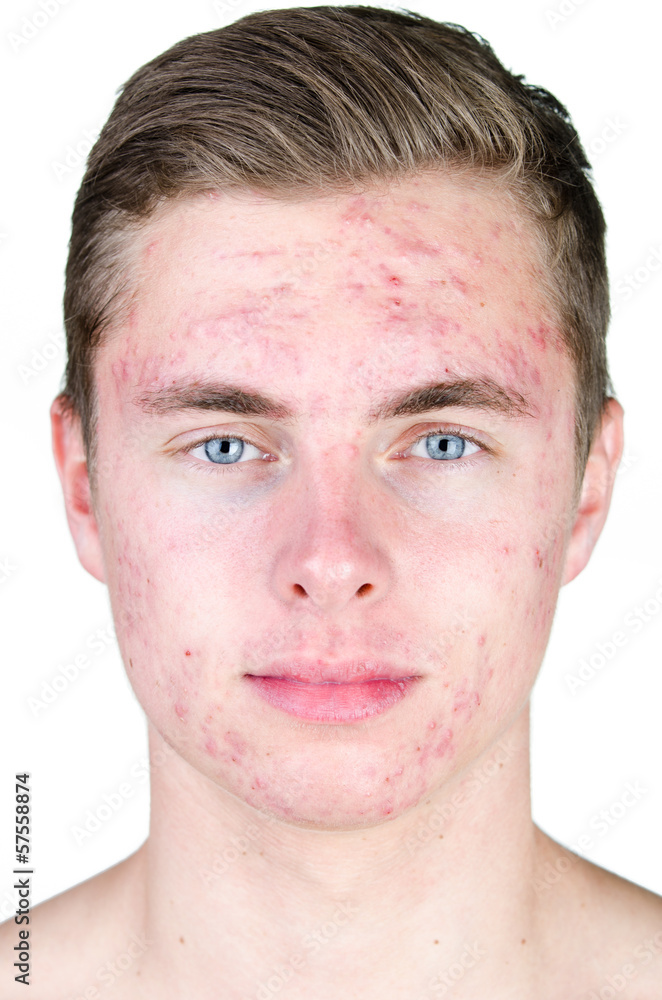 Obraz premium verpickeltes gesicht