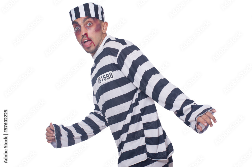Prisoner with bad bruises on white Prisoner with bad bruises on white