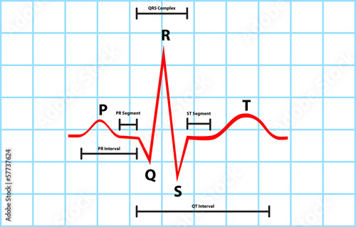 Normal Atrial And Ventricular Depolarization Description