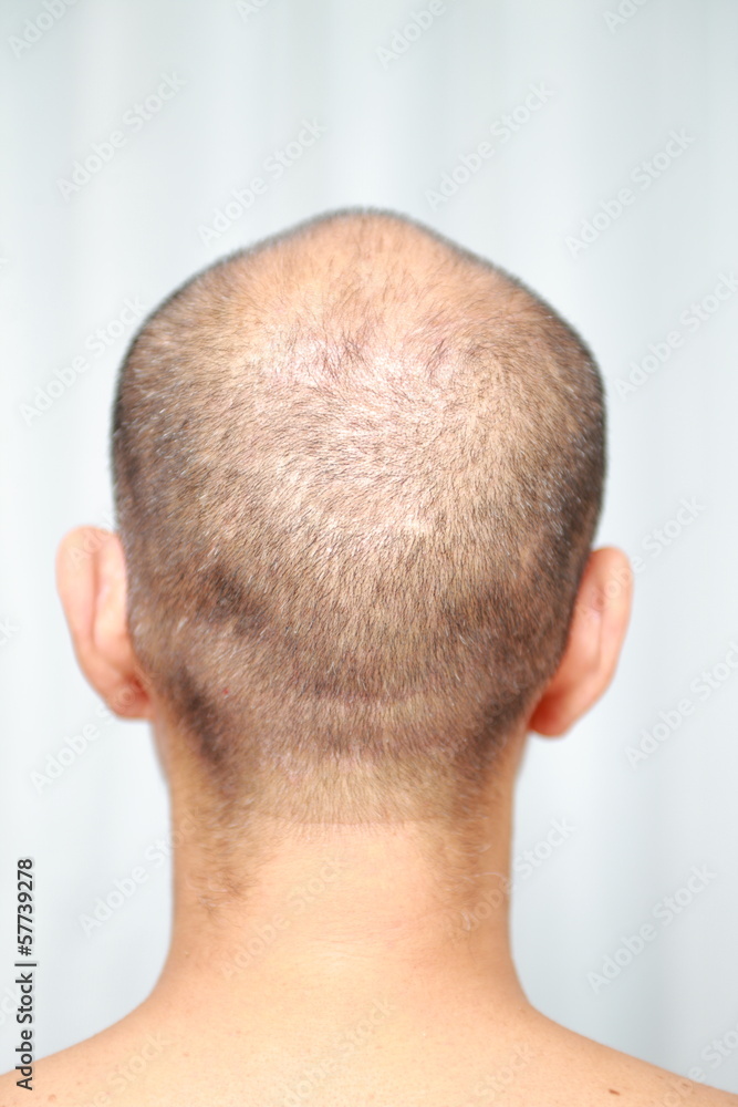Fototapeta premium 薄毛
