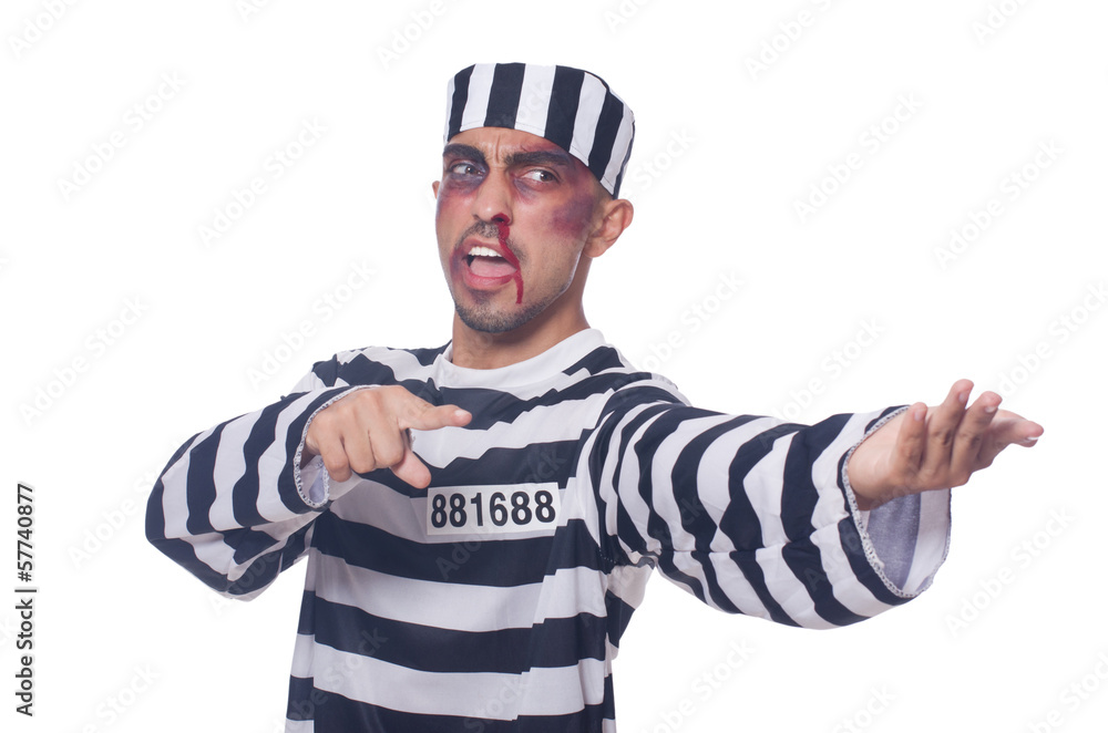 Prisoner with bad bruises on white Prisoner with bad bruises on white