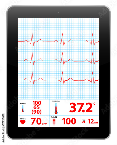 Modern Electrocardiogram Monitor Device Display