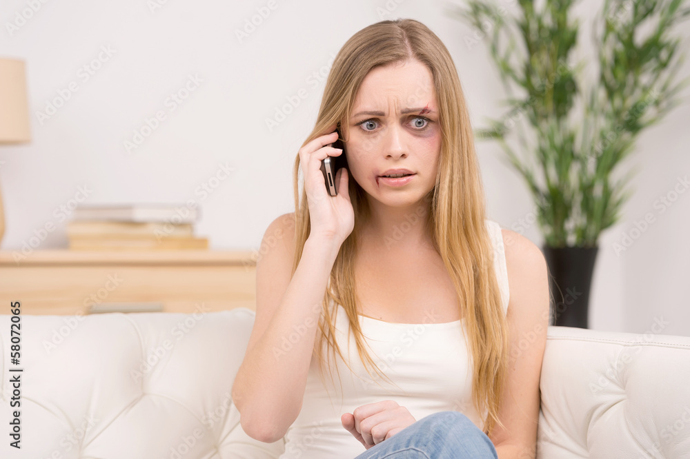 Scared woman with bruise on face calling to get help Scared woman with bruise on face calling to get help