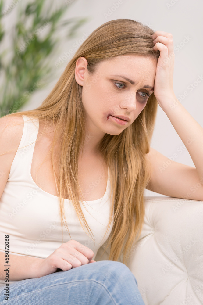 Fototapeta premium Portrait of thoughtful woman with bruise on her face.