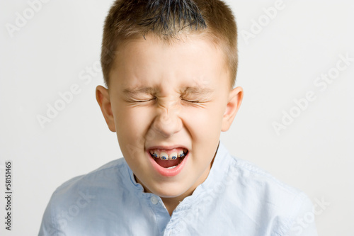 braces