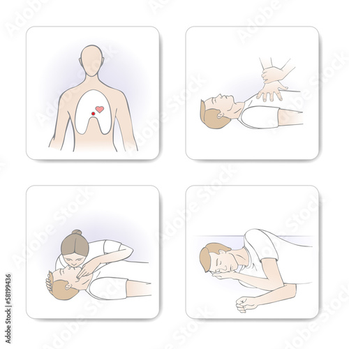 CPR