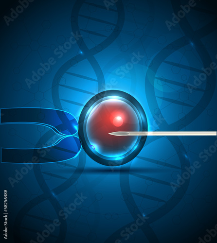 Artificial fertilization. Intracytoplasmic Sperm Injection.