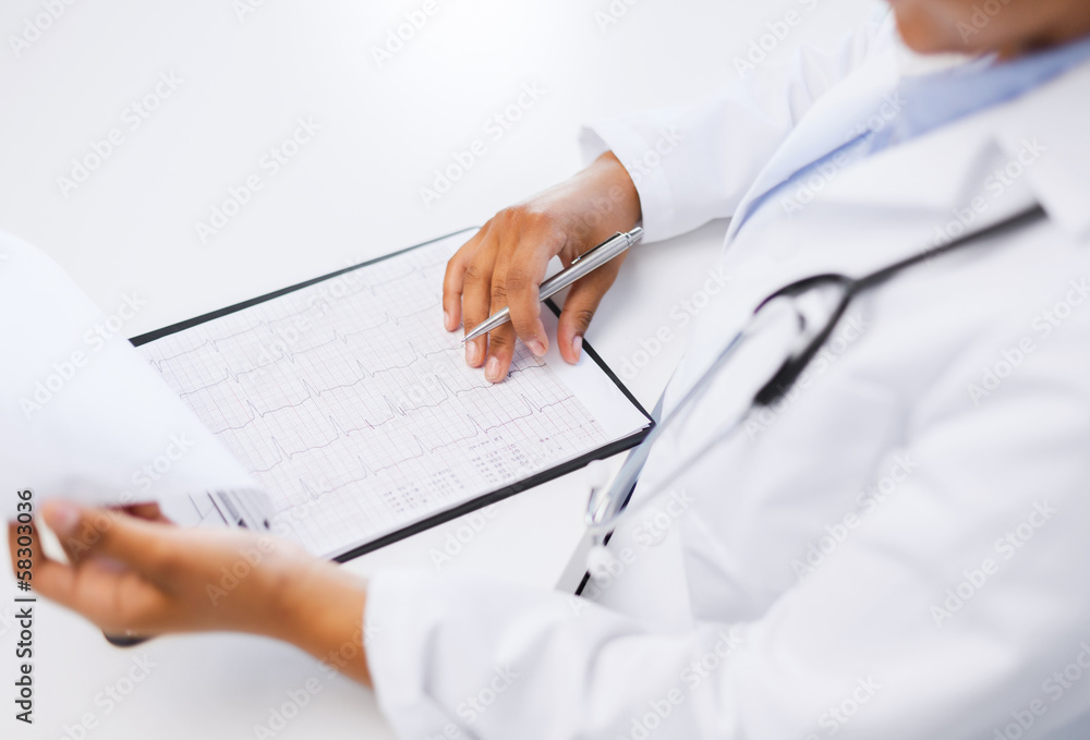 ауmale doctor studies cardiogram ауmale doctor studies cardiogram
