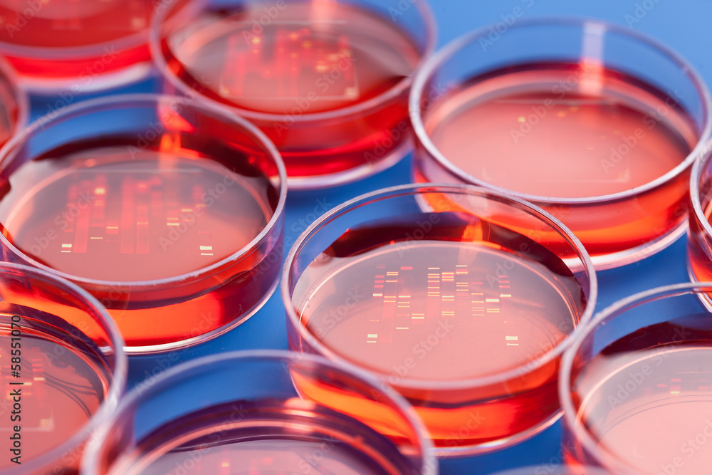 Petri dishes with samples for DNA sequencing Petri dishes with samples for DNA sequencing