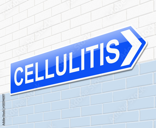 Cellulitis concept.