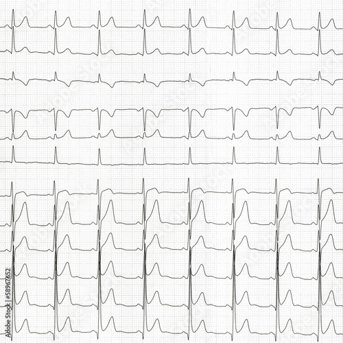 Quadro su tela cardiogram