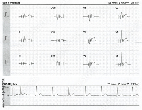 фотографія cardiogram