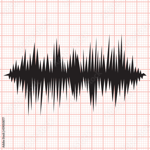 ekg line
