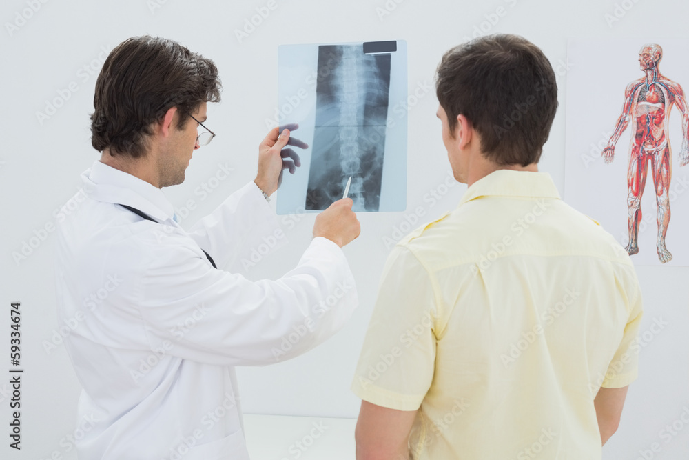 Obraz premium Male doctor explaining spine x-ray to patient