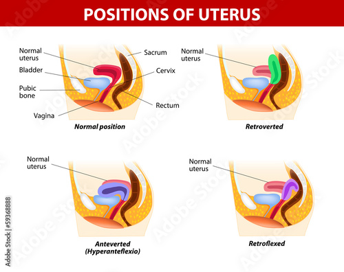 Positions of uterus