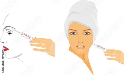 Cosmetic injection of hyaluronic acid