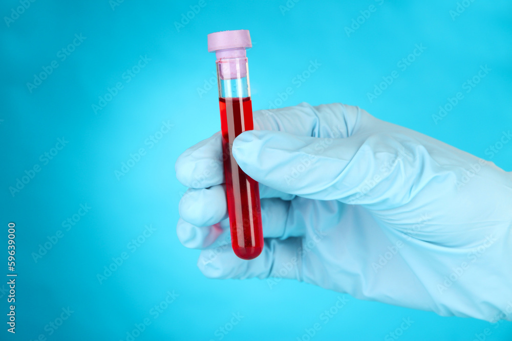 Test tubes with blood in hand on blue background Test tubes with blood in hand on blue background