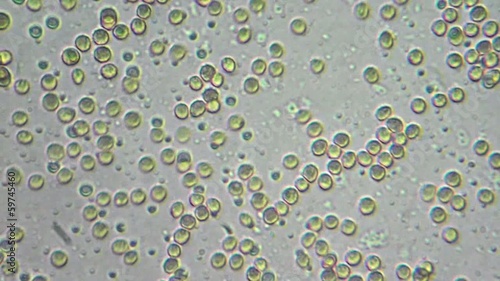 drop of my blood (erythrocytes) under microscope