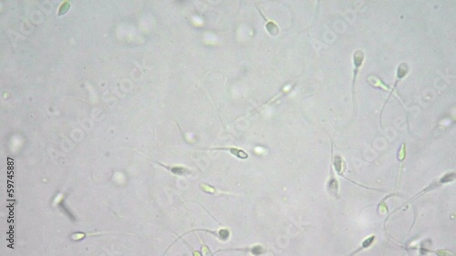 Helathy man sperm of good quality under microscope photo