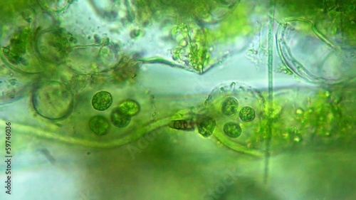 Seaweed (algae) under microscope, magnification 400x