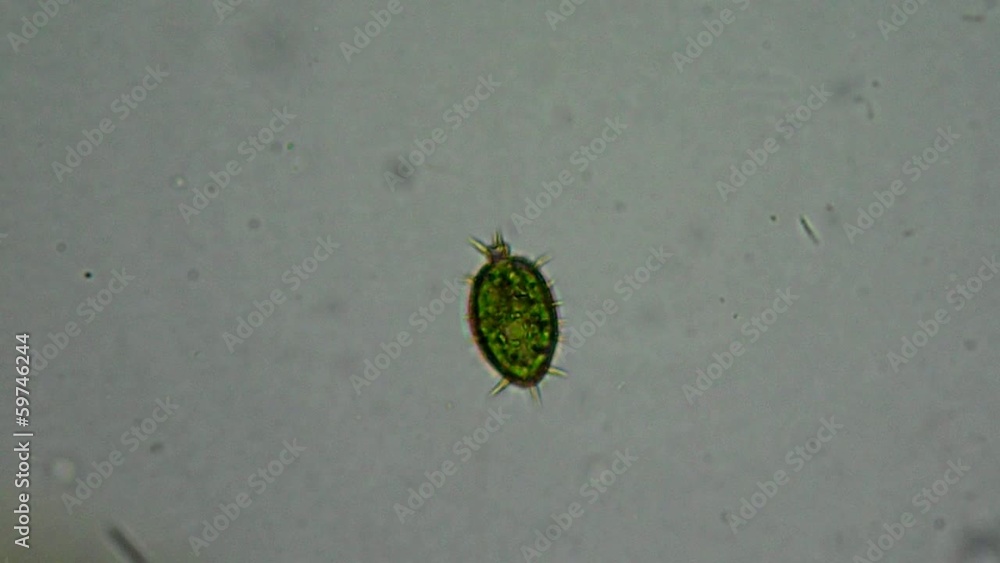 Green cyanobacteria colony under microscope Green cyanobacteria colony under microscope