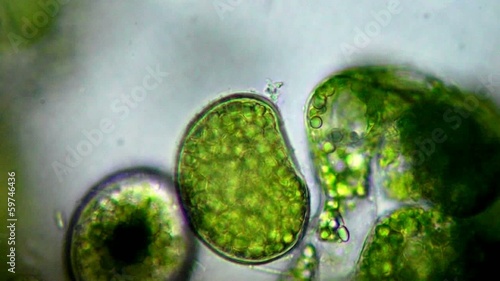 Seaweed (algae) under microscope, magnification 400x photo