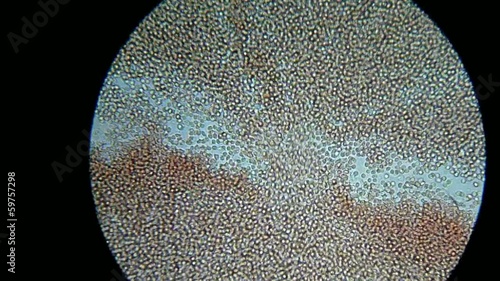 my blood under microscope