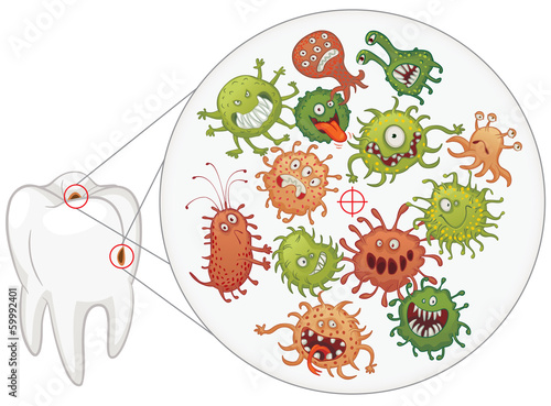 Caries. Funny bacteria and tooth