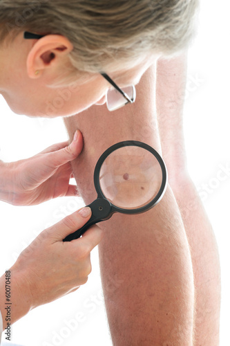 Dermatologist examines a mole