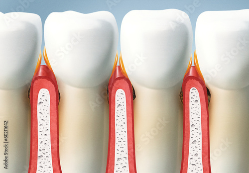 treat your teeth, periodontal